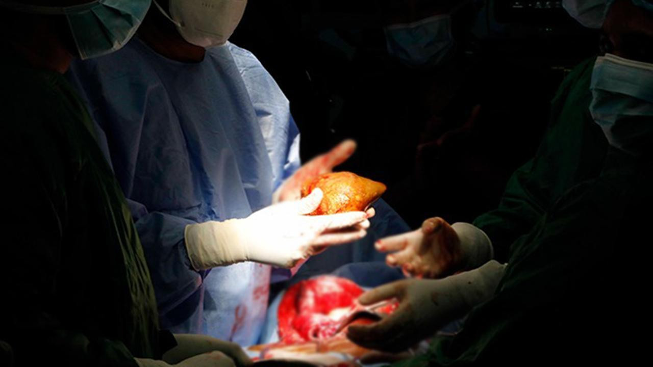 Kuduzlu böbrek nakli yapıldı, hayatını kaybetti